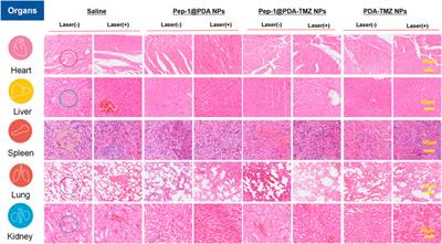 Polydopamine-based loaded temozolomide nanoparticles conjugated by peptide-1 for glioblastoma chemotherapy and photothermal therapy